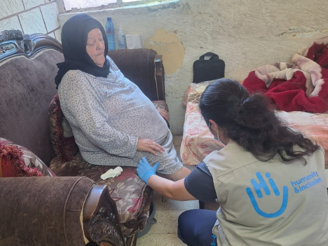 A woman with a lower leg amputation receiving physiotherapy